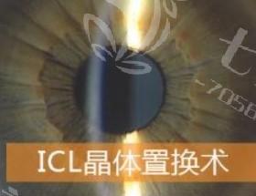 重庆EVO-ICL晶体植入（散光型）比较好的医院 榜单前11正规又好