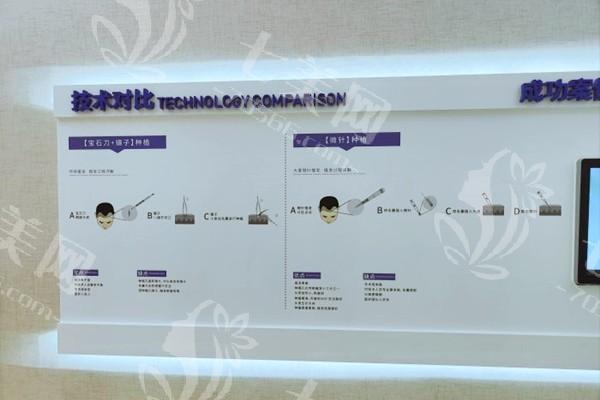 大麦植发怎么样好不好？正规连锁品牌技术靠谱收费透明